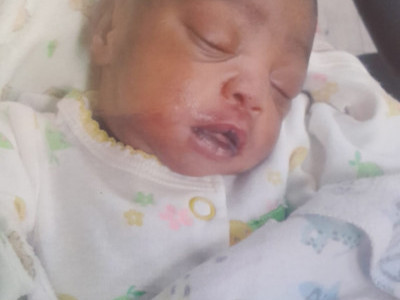 Help Baby girl shanalica hear:Ear canal surgery fund