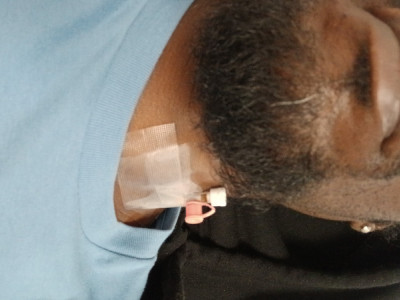 Surgery needed... asking kindly for any assistance