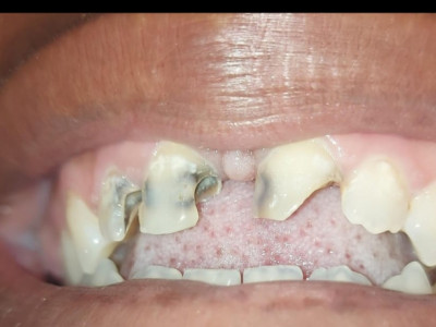 Requesting assistance to receive dental care