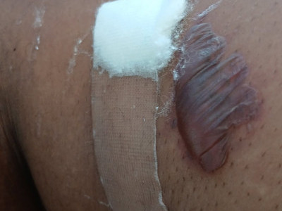 Help Me Cover My Medical Expenses