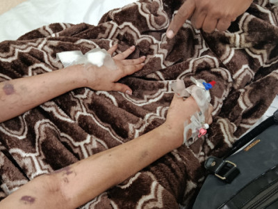 Help Us Support Jewel Dookeran in Her Fight Against Lupus