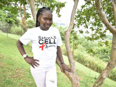 Sickle cell patient in need of a hip replacement surgery