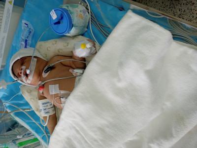 Help baby Kyon live a full life.