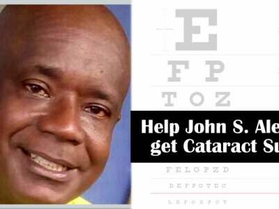 Cataract Surgery for John S. Alexander