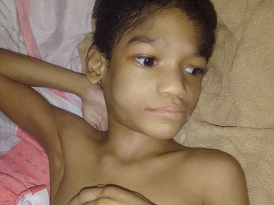 Medical Equipment For Triston Blackett