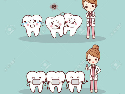 Braces Treatment