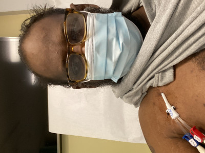 Kidney transplant to survive