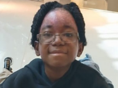 12-Year-Old Jaylon Fight Juvenile Dermatomyositis (JDM) Needs your Support